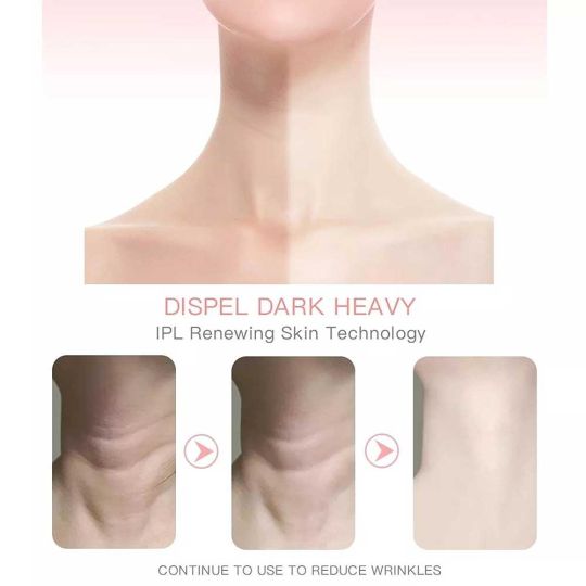 جهاز تجميل مضاد للتجاعيد